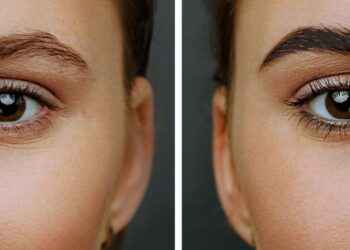 Cejas súper pobladas y perfectas con 7 tratamientos caseros que SÍ funcionan
