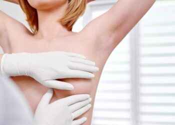 Mastopexia: beneficios estéticos y riesgos de elevar las mamas