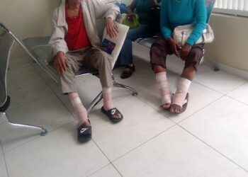 Hospitales Moscoso Puello y Cabral y Báez salvan extremidades a 430 pacientes con pie diabético en menos de dos años