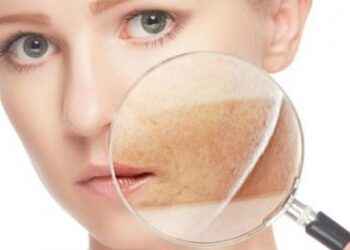 Activos vasoprotectores para calmar las pieles sensibles