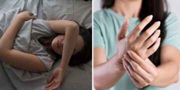 Qué significa despertar con el “brazo dormido”, ¿debería preocuparme?