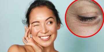 4 mascarillas para prevenir las “patas de gallo” (y otros consejos para una mirada joven)
