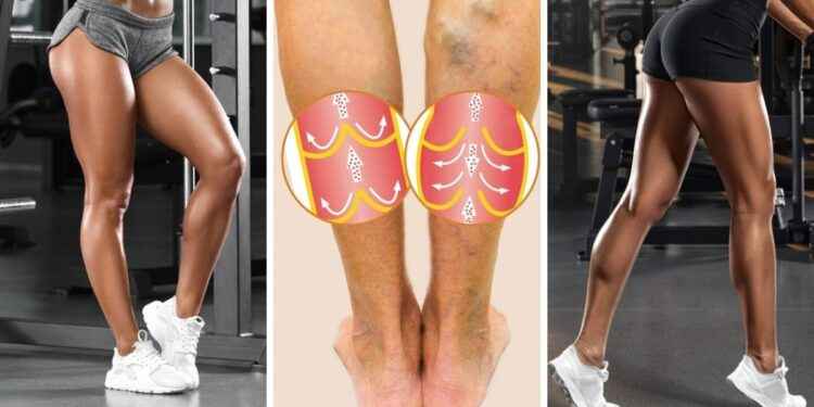 Piernas SIN VÁRICES : 7 ejercicios que aumentan la circulación sanguínea después de los 30 años
