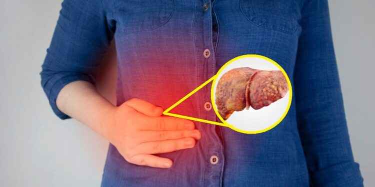 ¿Por qué se inflama el hígado y qué comer para reducir los problemas hepáticos?