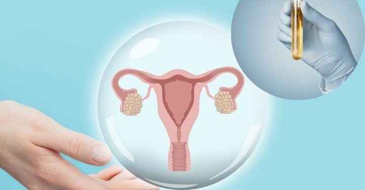 Crean prueba de orina que detecta el cáncer de útero en la comodidad de tu hogar
