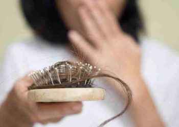 Pelo más fino, ensanchamiento de la raya… signos que delatan alopecia femenina