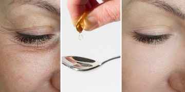Cómo usar la vitamina E para rejuvenecer el contorno de ojos