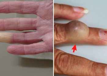 6 problemas de salud que se manifiestan en tus manos ¡NO tienes que ignorar!