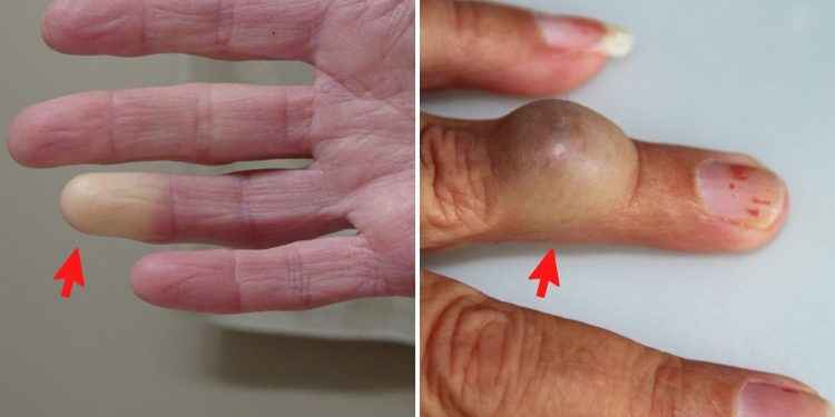 6 problemas de salud que se manifiestan en tus manos ¡NO tienes que ignorar!