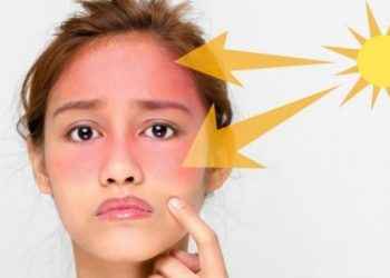 La peligrosa nueva tendencia de ‘TikTok’: ‘contouring’ con crema solar