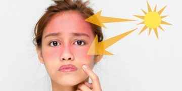 La peligrosa nueva tendencia de ‘TikTok’: ‘contouring’ con crema solar