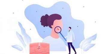 Los 5 motivos por los que merece la pena ir al dermatólogo