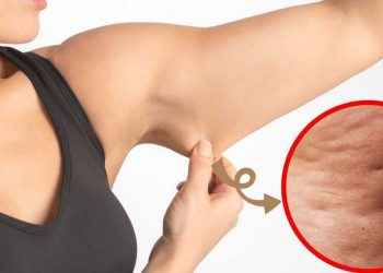 6 ejercicios para combatir la celulitis de los brazos: tonifica y afina