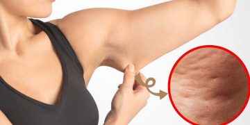 6 ejercicios para combatir la celulitis de los brazos: tonifica y afina