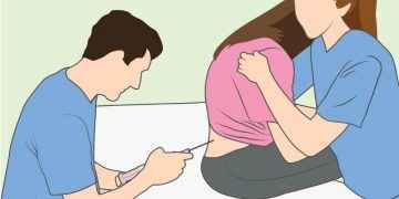 Analgesia epidural en el parto: beneficios y falsas creencias