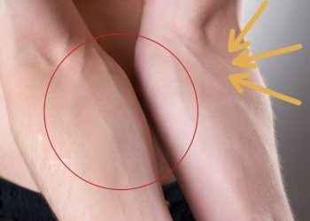 ¿Por qué las venas se ven verdes? Esto dicen los expertos