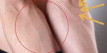 ¿Por qué las venas se ven verdes? Esto dicen los expertos