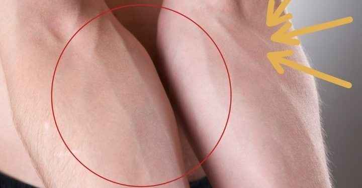 ¿Por qué las venas se ven verdes? Esto dicen los expertos
