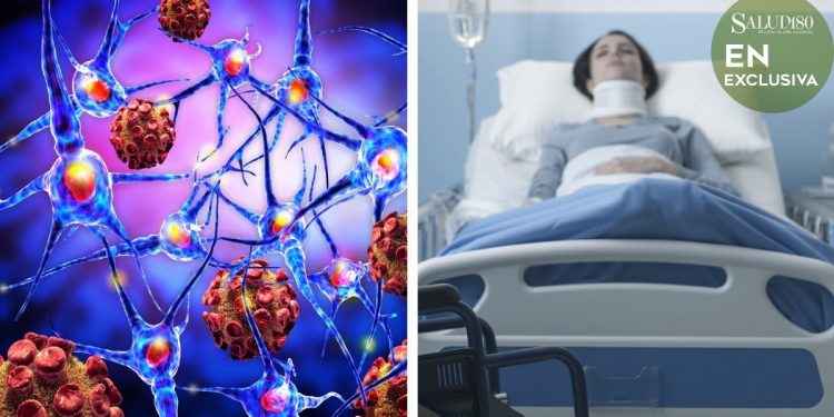 Esclerosis múltiple: una enfermedad autoinmune que afecta más a las mujeres, explica especialista