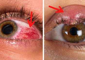 7 problemas de salud que puedes identificar con sólo ver tus ojos