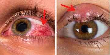 7 problemas de salud que puedes identificar con sólo ver tus ojos