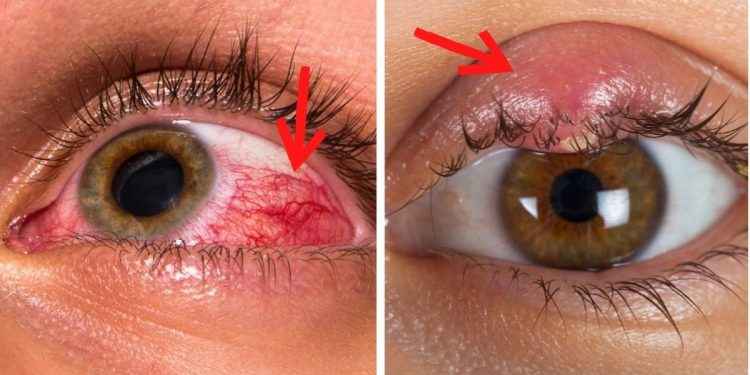 7 problemas de salud que puedes identificar con sólo ver tus ojos