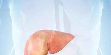 Hepatitis, un virus silente y altamente contagioso