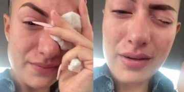 TikToker confunde gotas para los ojos y casi pierde la vista (video)