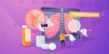 Motivos para prestar atención a la tuberculosis