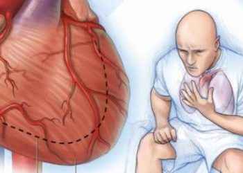 Insuficiencia cardiaca