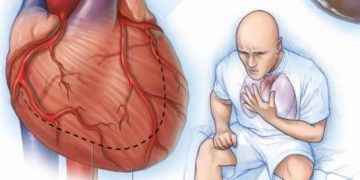 Insuficiencia cardiaca