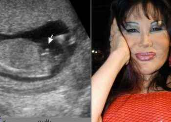 Lyn May reveló el género de su bebé con un ultrasonido