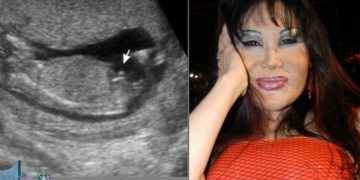 Lyn May reveló el género de su bebé con un ultrasonido