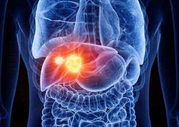 Cáncer de hígado