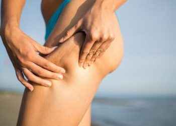 Celulitis y flacidez: puedes mejorarlas con tu dieta veraniega