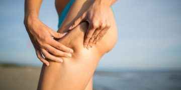Celulitis y flacidez: puedes mejorarlas con tu dieta veraniega