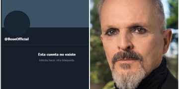 Miguel Bosé le sale huyendo a las redes sociales, se quita