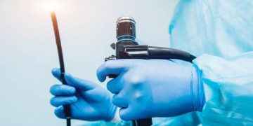 Dolor abdominal, diarreas, sangrado… razones para hacerse una endoscopia