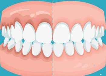 Enfermedades periodontales: cómo se previenen y tratan