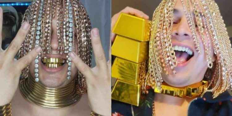 Rapero se implantó cadenas de oro en la cabeza y asegura ser ‘semidiós’