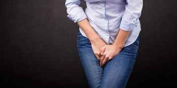 Candidiasis