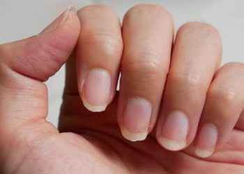 Mis uñas han cambiado de color, ¿es grave?