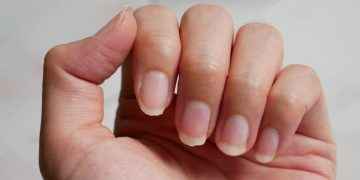 Mis uñas han cambiado de color, ¿es grave?