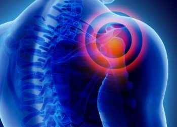 Claves para prevenir el dolor de hombro