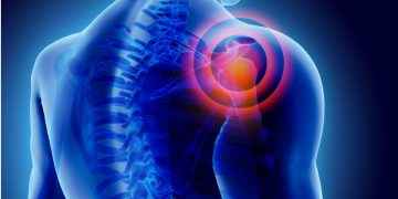 Claves para prevenir el dolor de hombro