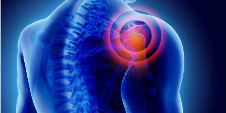 Claves para prevenir el dolor de hombro