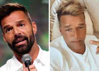Revelan la verdadera causa que originó el «cambio» de rostro en Ricky Martin