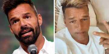 Revelan la verdadera causa que originó el «cambio» de rostro en Ricky Martin