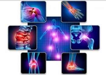 Viscosuplementación, la solución para tratar efectivamente la Osteoartritis en todas sus fases