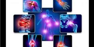 Viscosuplementación, la solución para tratar efectivamente la Osteoartritis en todas sus fases